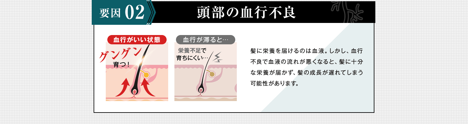 頭部の血行不良
