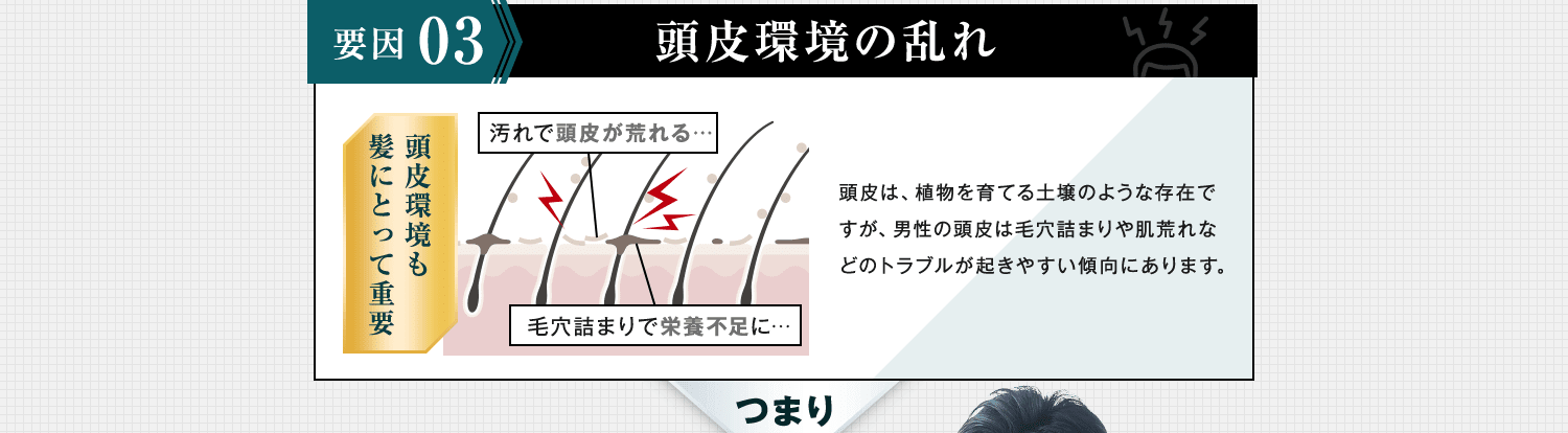 頭皮環境の乱れ